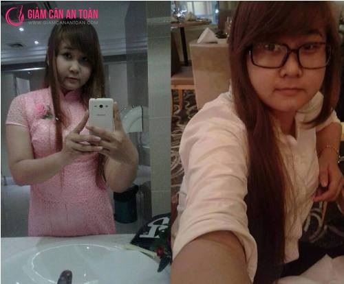 Cô gái giảm thành công 12kg chỉ trong 1 tháng với viên uống giảm cân Rich Slim